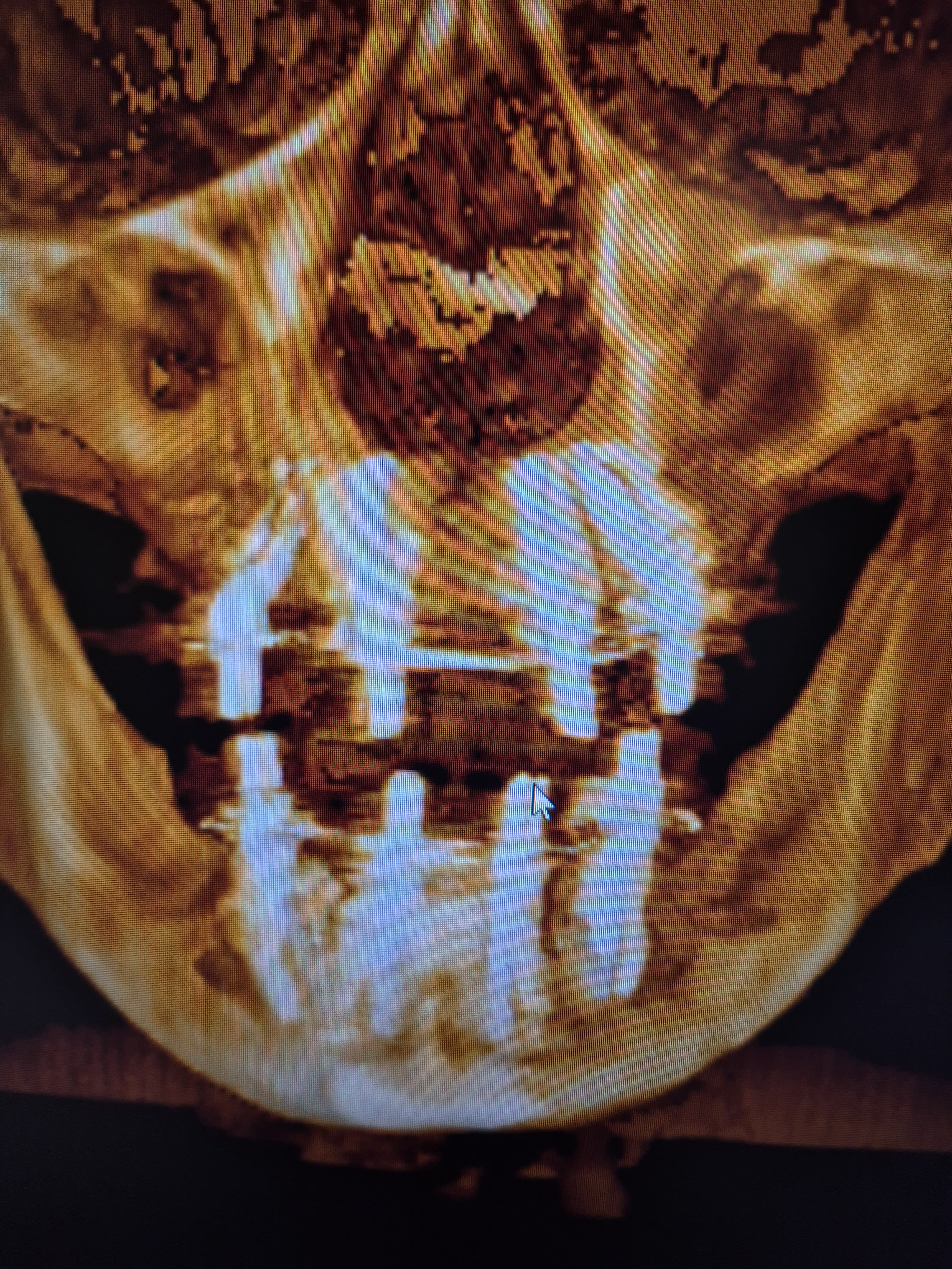 Digital dentistry workflow